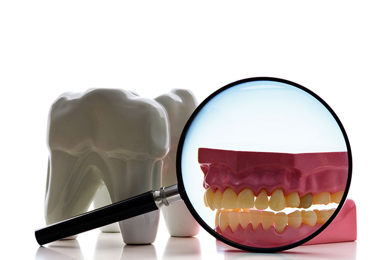 Root Canal Treatment in Clarksville