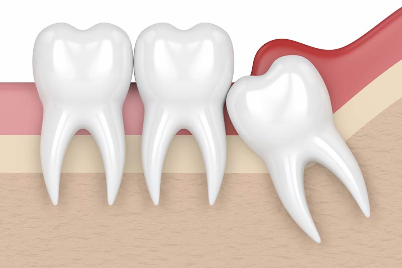 Oral Surgery in Clarksville